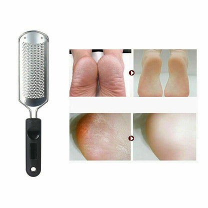 Pro 2 In1 Foot Callus Remover File Rasp Scraper Cracked Pedicure Rough Tool Colossal Foot Scrubber - Plush Fashions Shop 